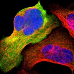 ENO3 Antibody, Novus Biologicals 25 &mu;L | Buy Online | Novus Biologicals | Fisher Scientific